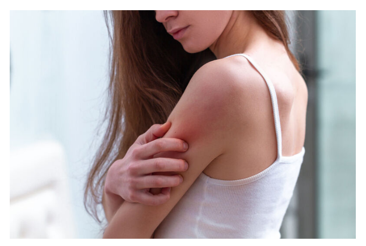 How to Assess Symptoms Similar to a Skin Rash Caused by Cancer